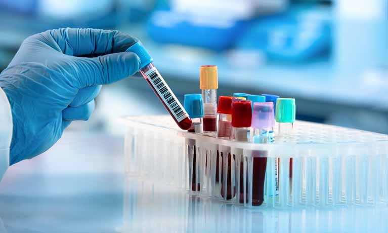 Person in lab with test tubes and pipits on the table